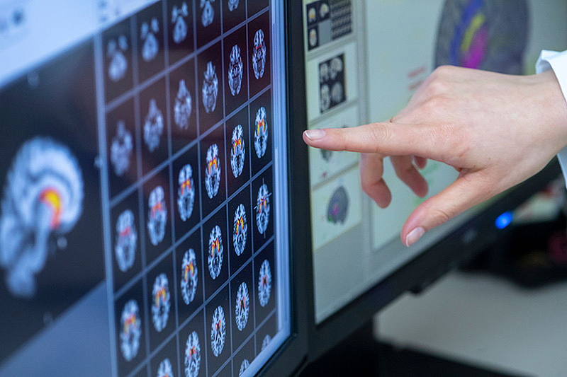 Hand zeigt auf einen Bildschirm mit mehreren farbigen Gehirnscans in Kacheln