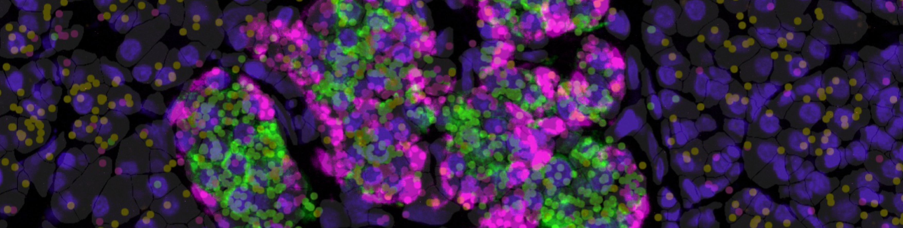 Islet Spacial Transcriptomics: Mikroskopische Aufnahme von Zellstrukturen mit farblich markierten Bereichen in Grün, Pink und Gelb auf dunklem Hintergrund