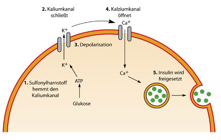 Graphik mit dem Wirkmechanismus der Sulfonylharnstoffe und Glinide